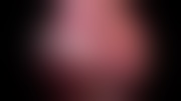 IOC: Intraoperative Cholangiography - Mr Kamran Qurashi - Mr Cosimo Alex Leo