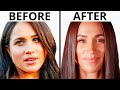 Meghan Markle&#39;s Royal Transformation | Plastic Surgery Analysis