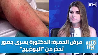 الدكتورة يسرى جمور تكشف عن أعراض مرض 