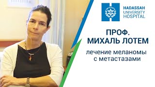 Иммунотерапия меланомы в Израиле: МЦ 