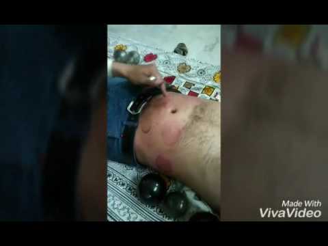 reduce kgs days to 15 6 how in Cupping Demonstration Weight Doovi loss for reduce kgs days to 15 6 how in Cupping Demonstration Weight Doovi loss for