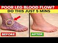 Poor Leg Circulation? 3 Easy & FAST Exercises