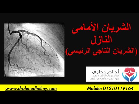 سلسلة الشريان التاجى 17 الشريان الأمامى النازل الشريان التاجى الرئيسى انسداد الشريان الأمامى