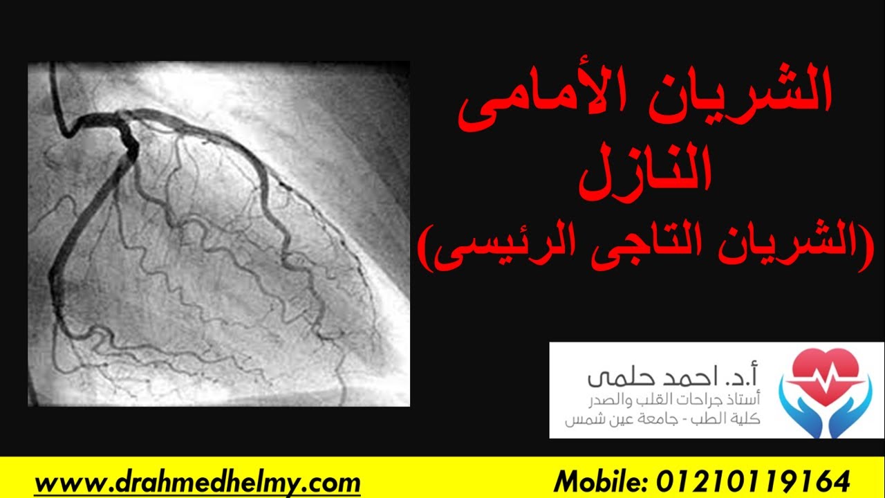 سلسلة الشريان التاجى ( 17)  الشريان الأمامى النازل - الشريان التاجى الرئيسى - انسداد الشريان الأمامى