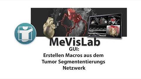 MeVisLab: GUI: Macro aus TumorSeg Netzwerk