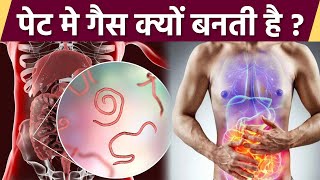 पेट में गैस क्यों बनती है । पेट में गैस बनने का कारण । Boldsky *Health screenshot 5