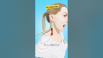 Arrow save her life? Amazing😍  #arrow #doctor @zackdfilms