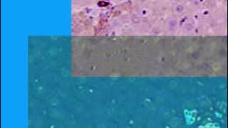 CF6D1183C51CCD9C327D35CB0C721C#5