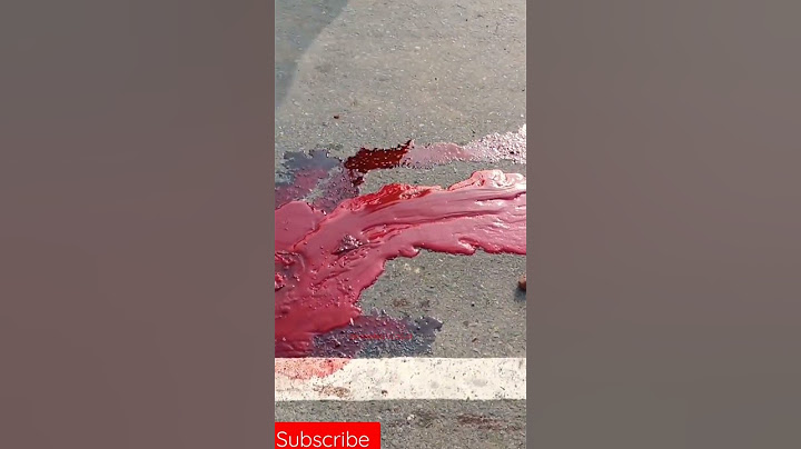 একটি মর্মান্তিক বাইক এক্সিডেন্ট //bike accident \\#shorts #shortvideo #foryou #village #shortviral