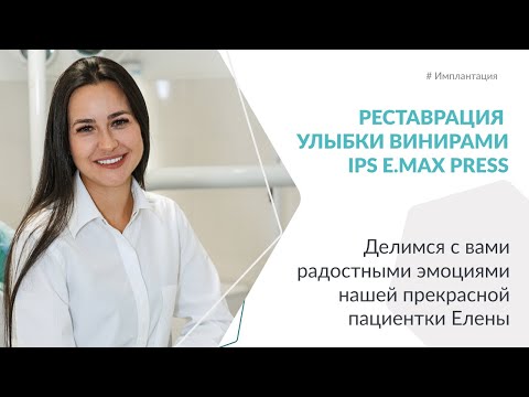 Эстетическая реставрация улыбки ультратонкими винирами.