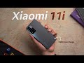 Xiaomi 11i HyperCharge: 120W But...