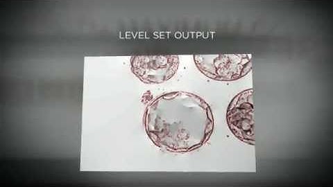 Automatic Trophectoderm Segmentation