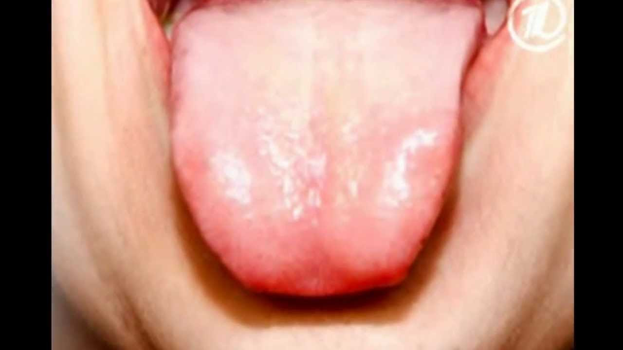 После минета пятна на языке После минета пятна на языке
