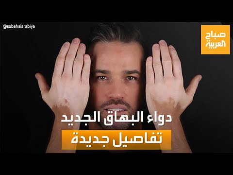 فيديو: ما هي العلاجات الموجودة للدببة؟