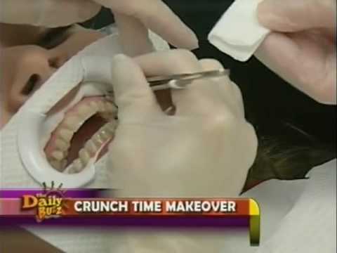 Orlando Cosmetic Dentist Dr Pitts Performs Crunch ...