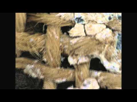 Microscopic examinations of the ancient Egyptian shroud