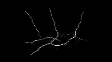Structured illumination of Neuronal Cells