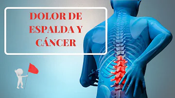 ¿Qué tumor causa dolor de espalda?