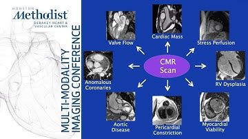Cardiovascular MR: Basic Principles and Overview of Technique (Dipan Shah, MD) September 28, 2021