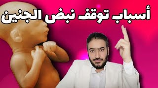 أسباب توقف نبض الجنين