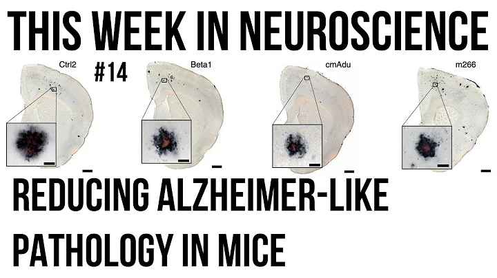 TWiN 14: Reducing Alzheimer-like pathology in mice