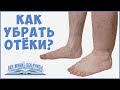 ОТЁКИ. Причины отёков. Как убрать отёки. Задержка Воды. Фролов Ю. А . Часть 1.