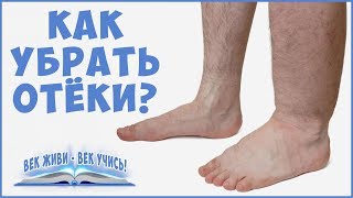 ОТЁКИ. Причины отёков. Как убрать отёки. Задержка Воды. Фролов Ю. А . Часть 1.