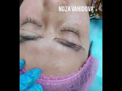 #морщины #броулифтинг #процес - YouTube