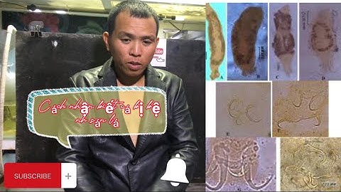 Cách nhận biết cá bị bệnh sán lá (Tài Cá VLog)