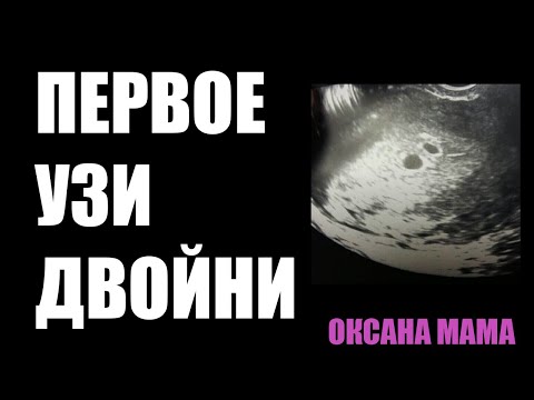 Первое узи. Беременность двойней 5 недель.  Первый триместр