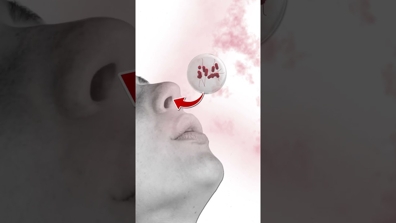 Can one become infected by legionellosis at home? - La Minuterie