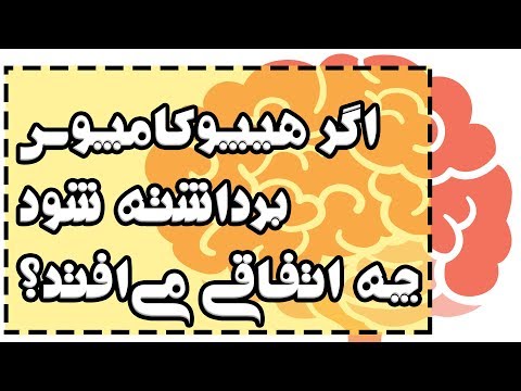 اگر هیپوکامپوس مغز برداشته شود چه اتفاقی می‌افتد؟