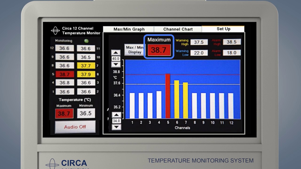 CIRCA Temperature Monitor – CIRCA's S-CATH™ Hot & Cold Esophageal Temperature  Monitoring System