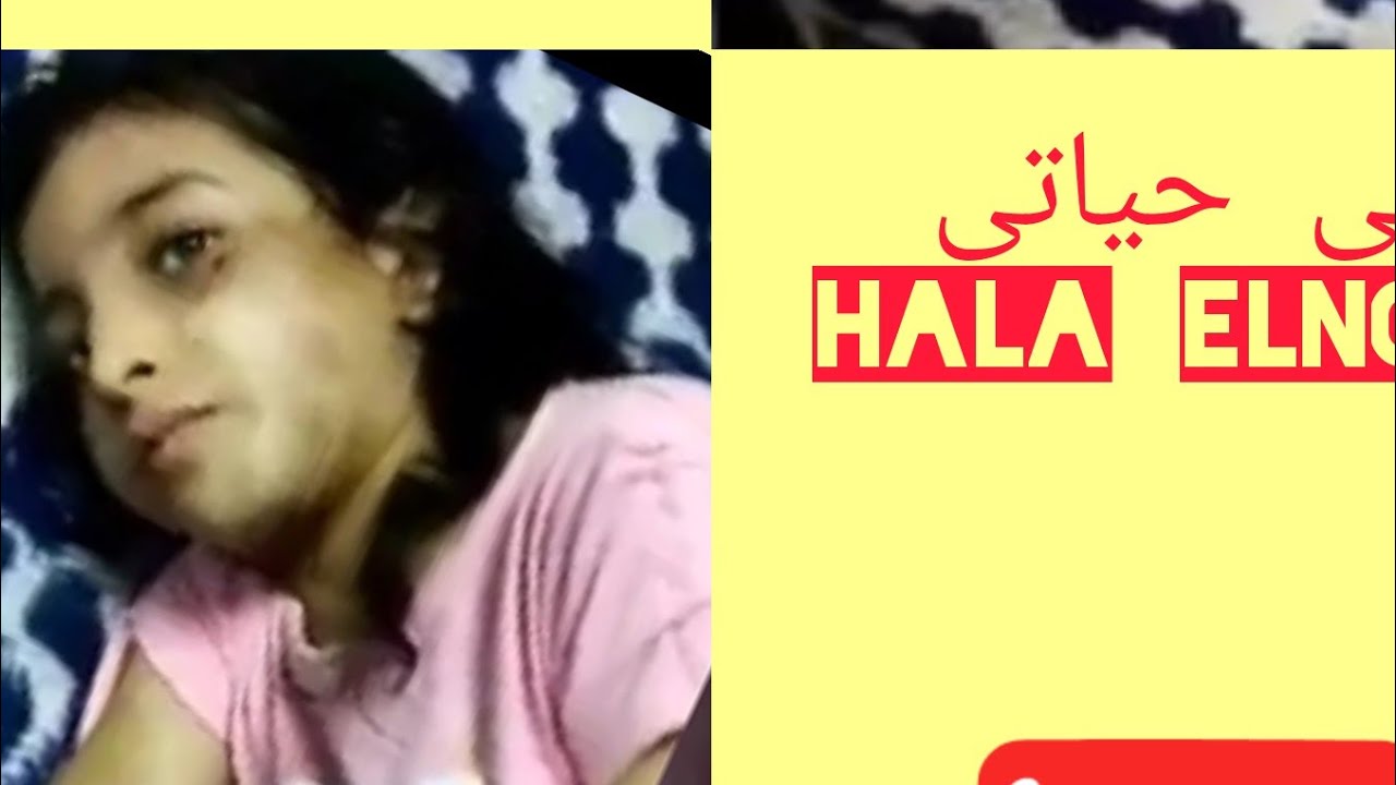 ضرب وتعذيب وحرق طفله من زوجة ابوها Youtube 