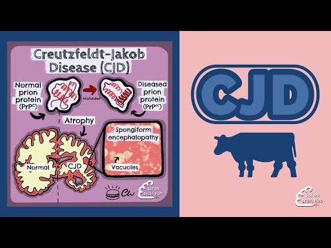 Creutzfeldt -Jakob ਰੋਗ (CJD)