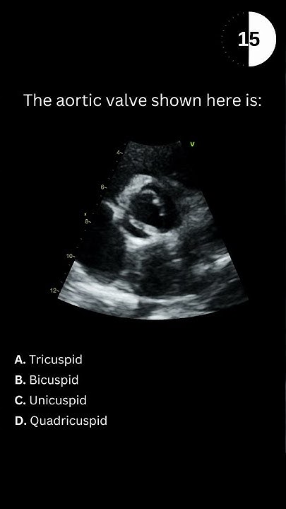 Echocardiography board practice question #01 - YouTube