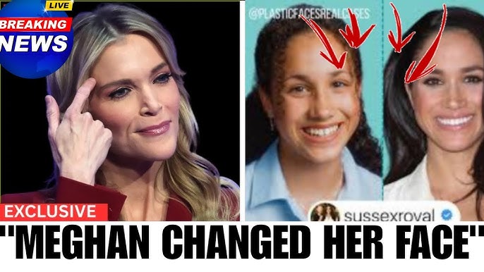 Meghan Markle SEETHING After Megyn Kelly REVEALS Hidden Surgery Secrets - YouTube