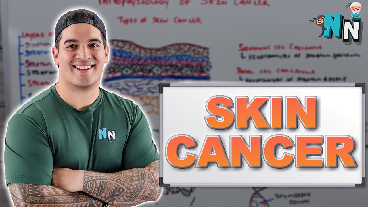 Skin Cancer | Clinical Medicine