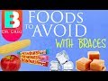 Foods to Avoid with Braces and Why