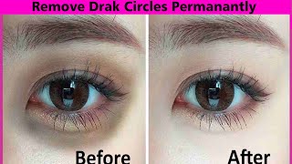 Remove Dark Circles Permanently  in 3 Days (100% Results) || Home Remedy