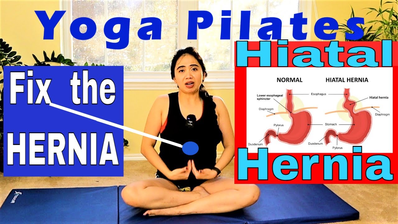 Bulge On Upper Abdomen Fix Hiatal Hernia Gentle Easy Mat Yoga Pilates