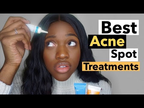 Best Acne Spot Treatment | How To Get Rid of Acne Fast