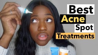 Best Acne Spot Treatment | How To Get Rid of Acne Fast