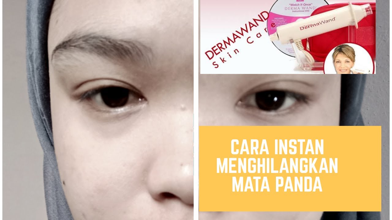 Menghilangkan mata panda atau kerutan secara instan - YouTube
