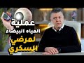 عملية المياه البيضاء لمرضى السكر دكتور عمرو الأمين 
