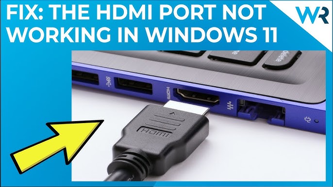 How to Fix HDMI Not on Laptop Windows 10? Methods] -
