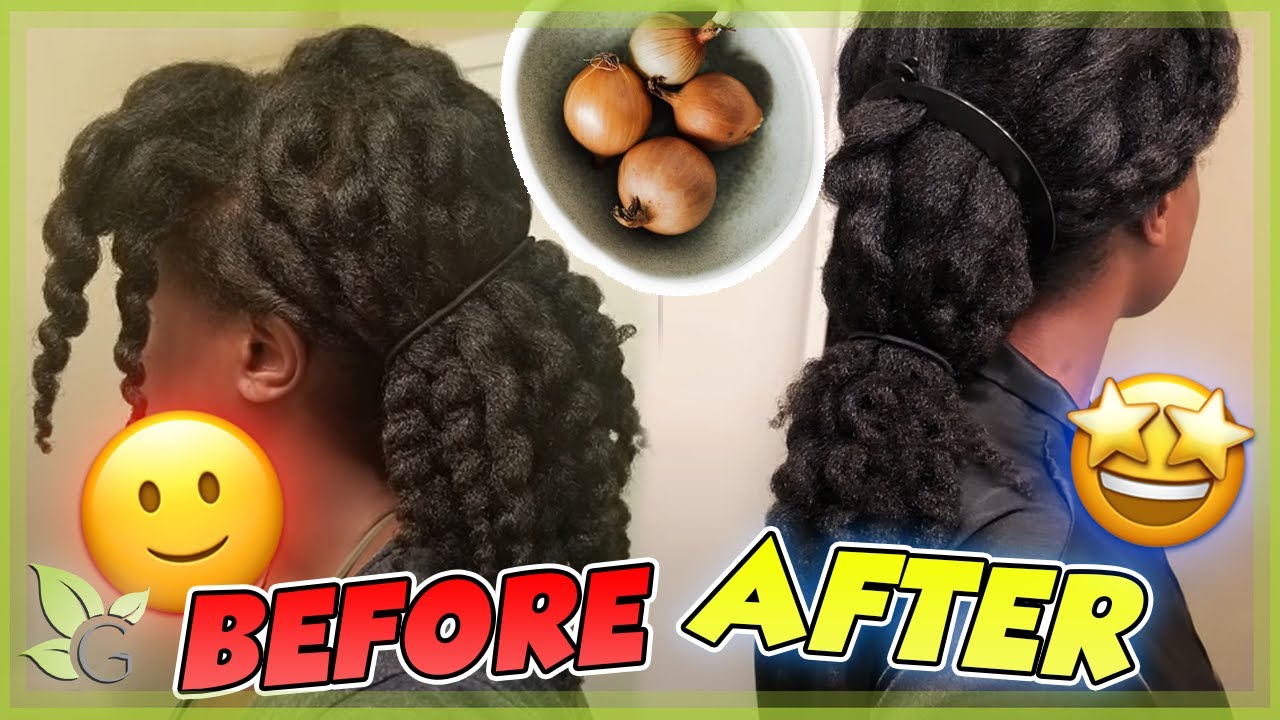 Я использовал свой рецепт ЛУКОВОГО СОКА в течение 1 ГОДА! — Посмотрите на результаты