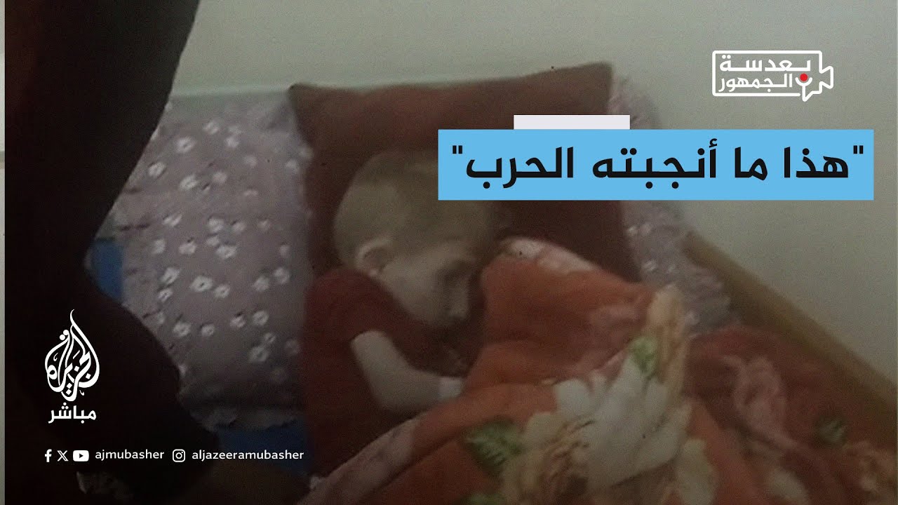 بعدسة الجمهور.. ظروف مأساوية يعاني منها الأطفال في مستشفى كمال عدوان