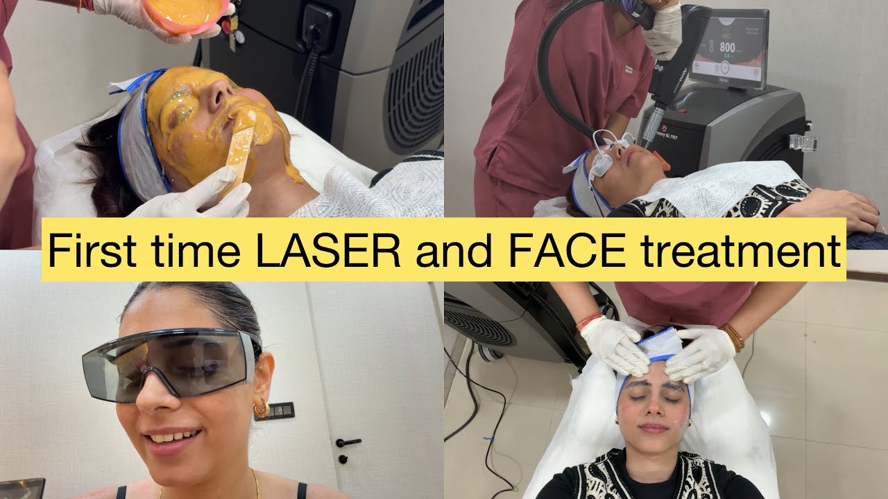 My HONEST review for LASER HAIR TREATMENT 🫶🏻