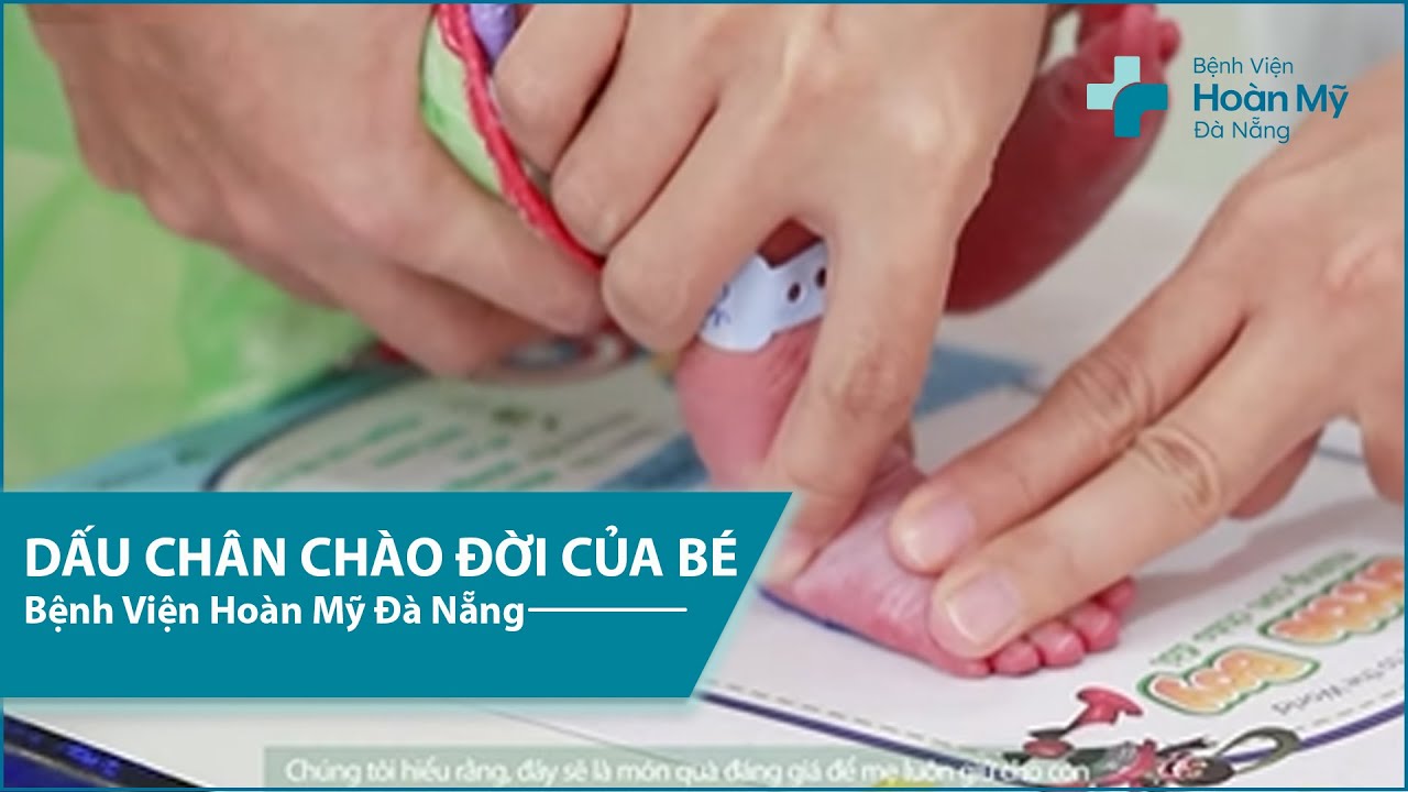 Footprint – Dấu chân chào đời của bé | Bệnh viện Hoàn Mỹ Đà Nẵng